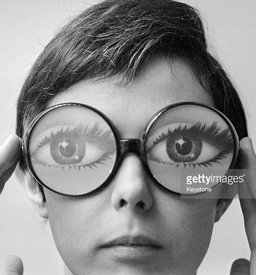 Photo Credit: Keystone, gettyimages.com, woman with abnormally large eyes.